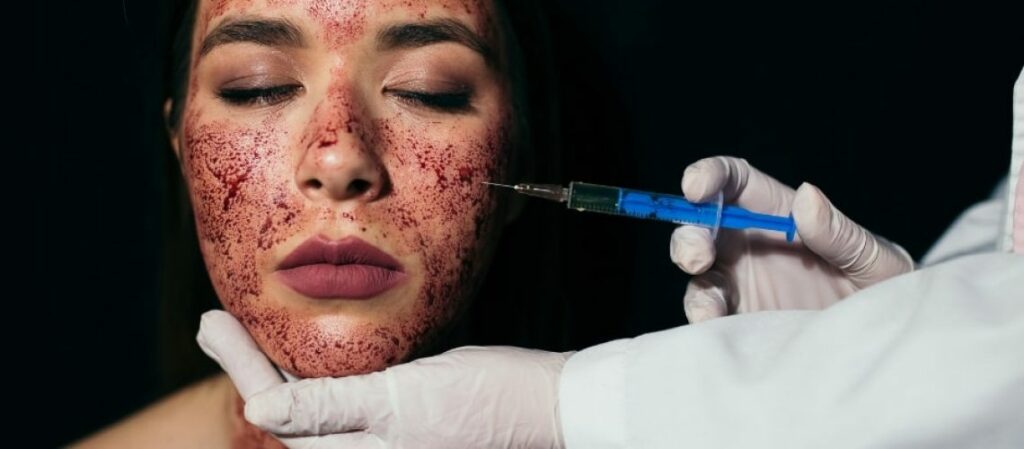 Vampire Facial treatment | Resurgence Wellness in Arlington, TX